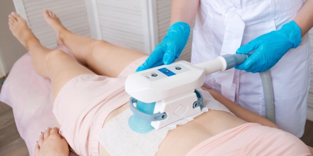 CoolSculpting for Men: Is It Effective?