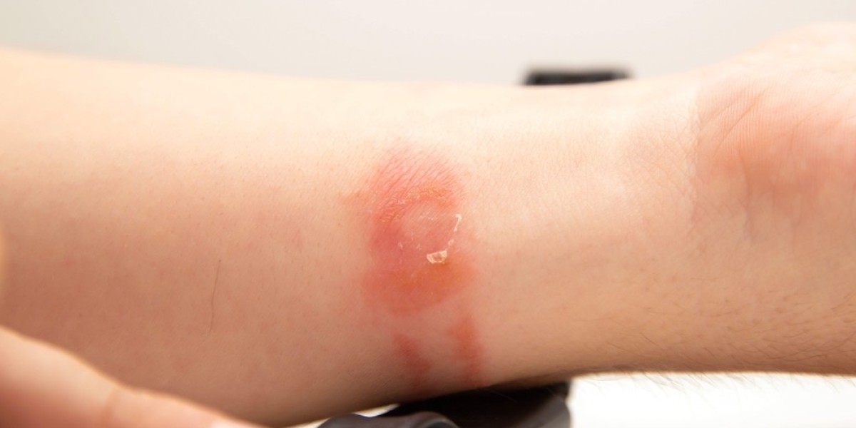 How to Avoid Common Skin Allergens Every Day