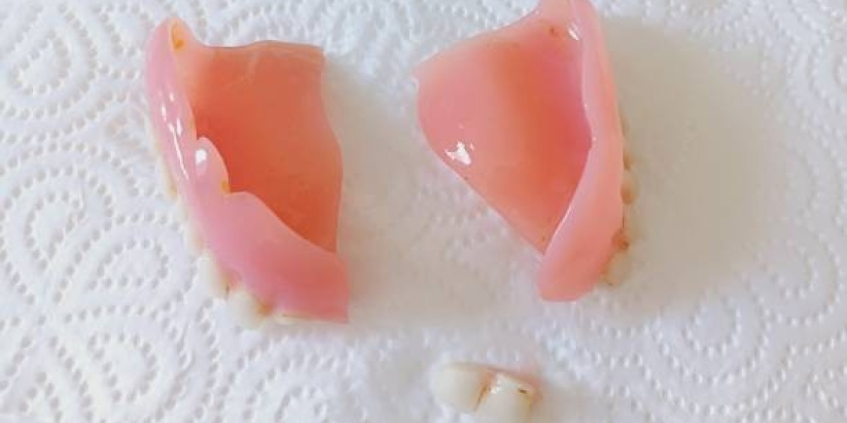 Comprehensive Guide to Managing Tooth Fractures in Pakistan