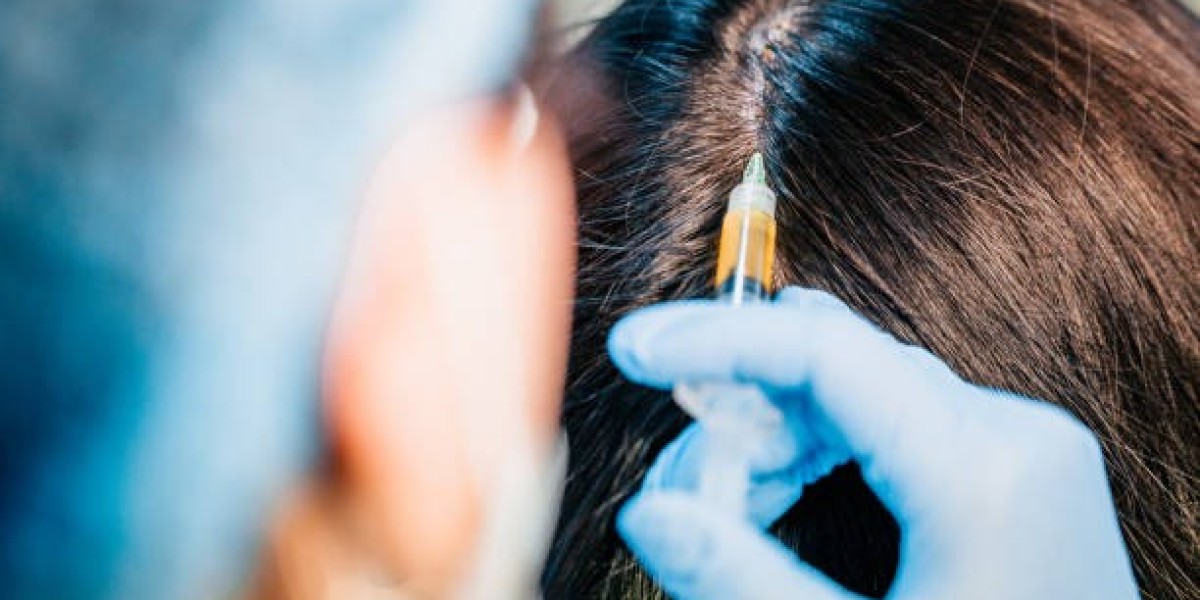 FUE Hair Transplant in Islamabad – Latest Approach for Natural and Permanent Hair Growth