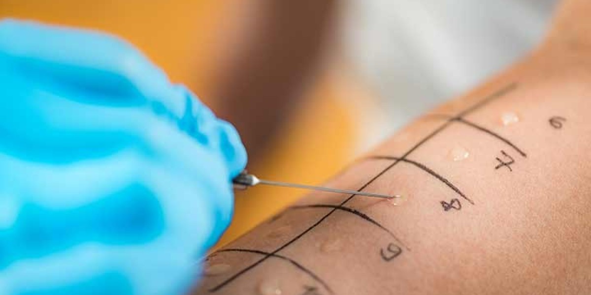 Trusted Allergist Irvine Specialists for Accurate Diagnosis and Care