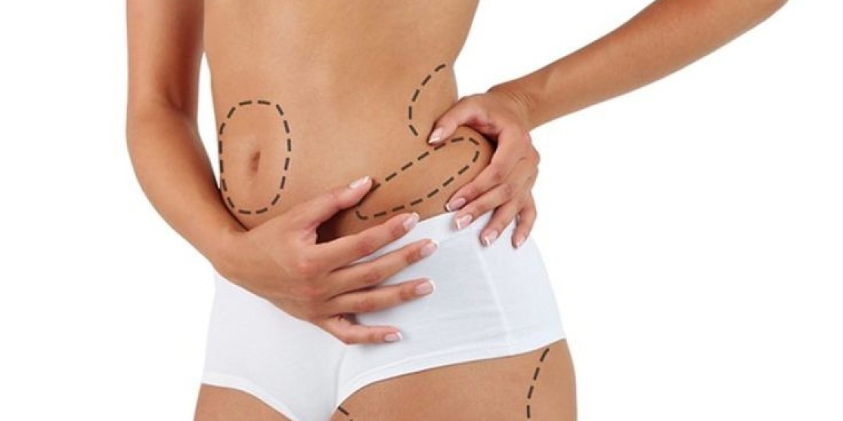 Laser Liposuction Glow for Beautiful Confidence Rise