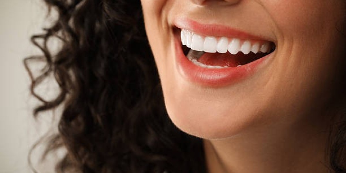 Complete Patient Journey, Technology, and Smile Longevity Dental Veneers in Islamabad Pakistan: