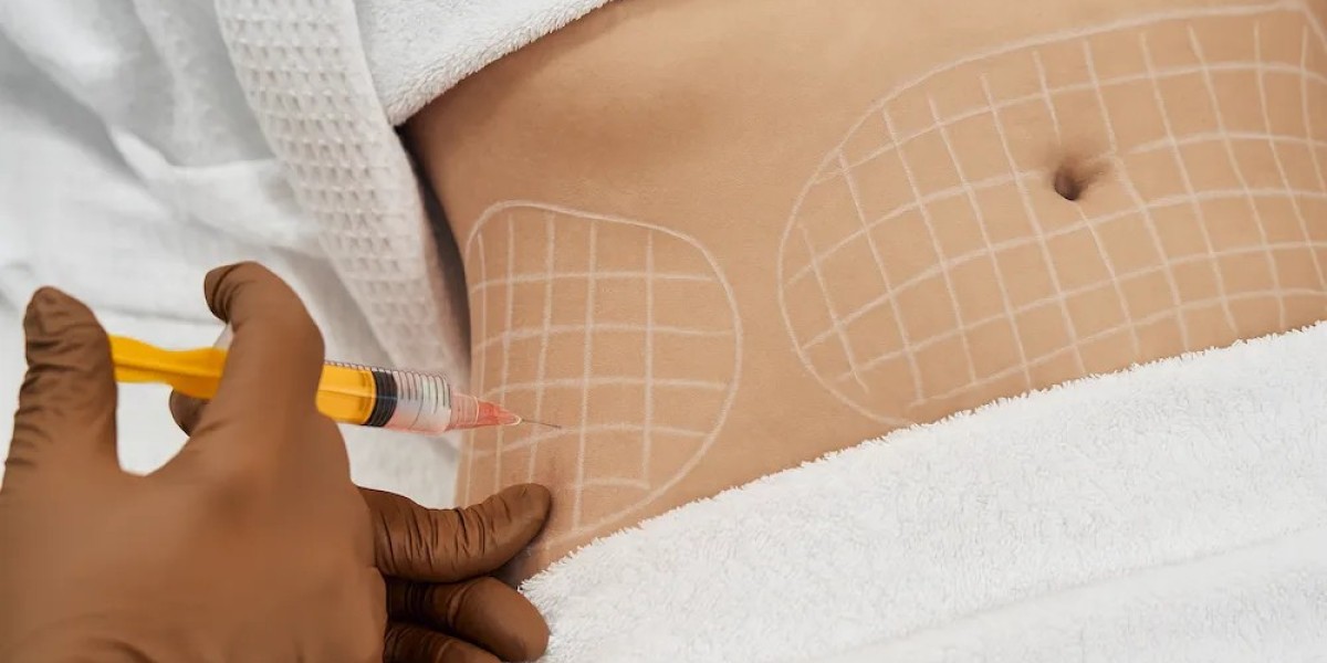 Can Fat Melting Injections help create a flatter stomach look?