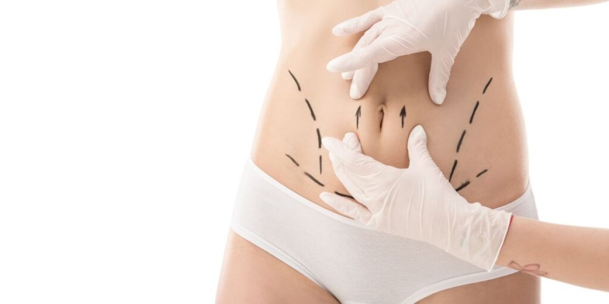 Vaser 4D Liposuction Help Achieve a Chiseled Body Look
