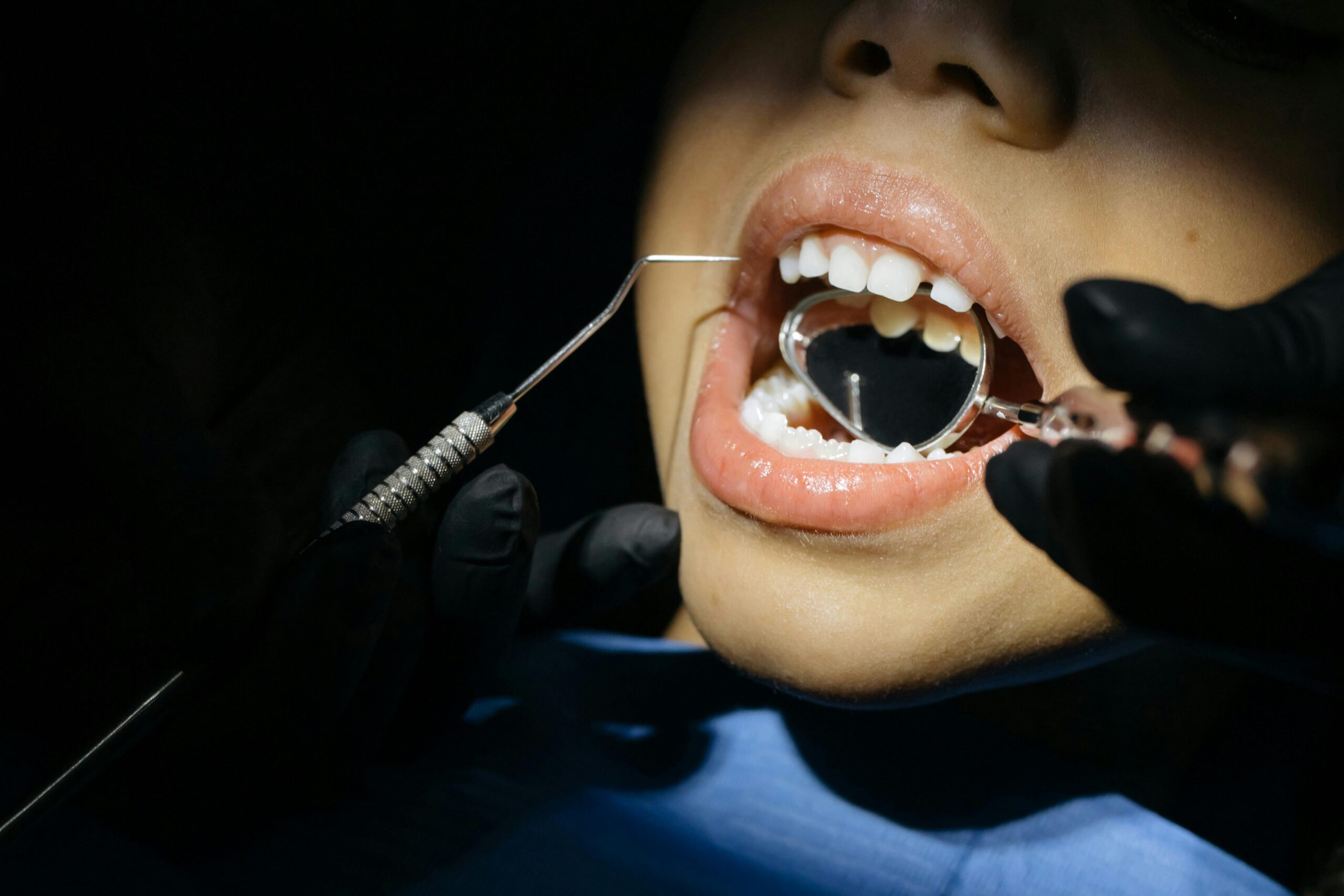 Norwalk Pediatric Dentist | Westport | Darien | Wilton | Spring Hill