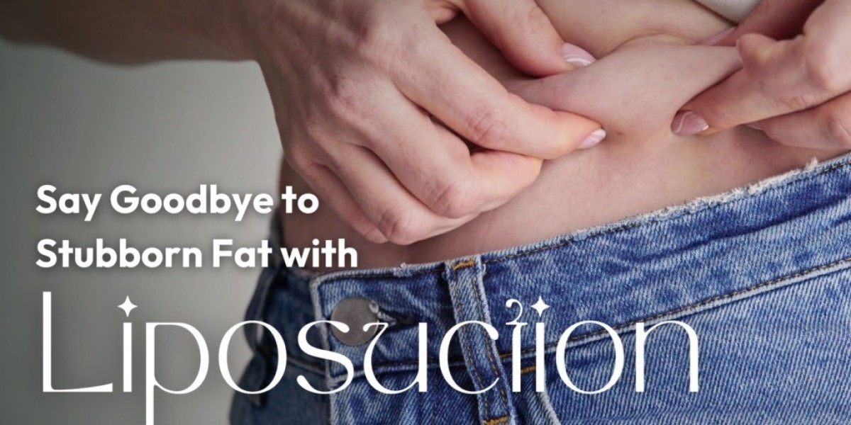 What Are the Benefits of Liposuction in Islamabad?